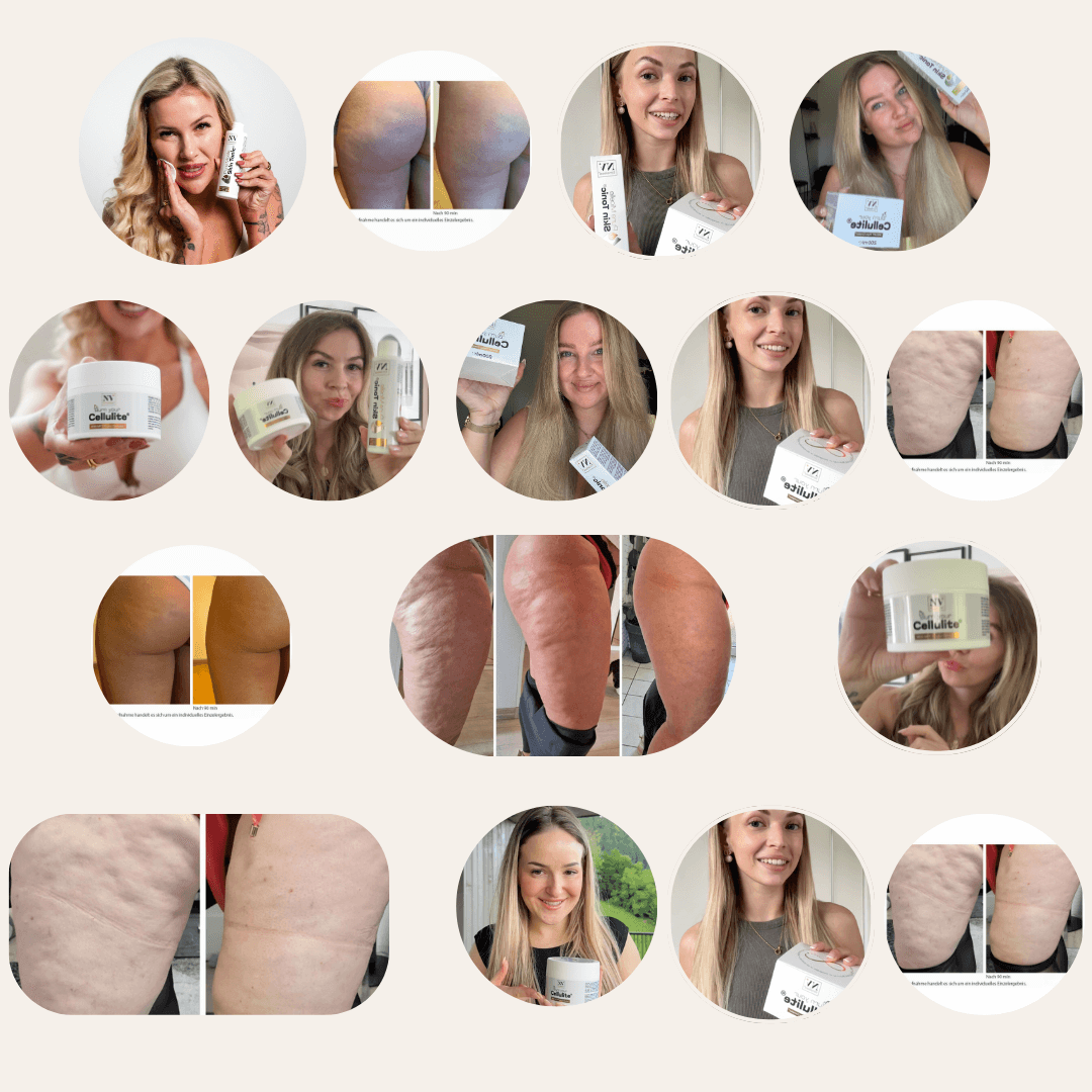 BurnYourCellulite